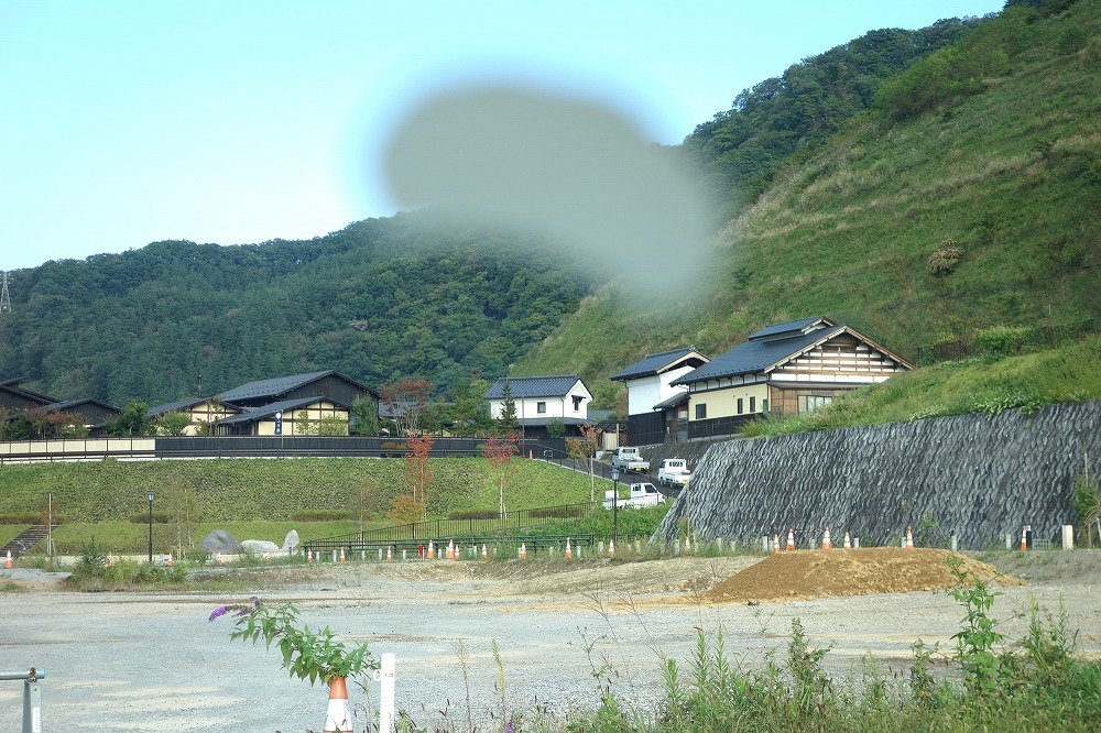 緑内障の症状